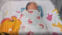Cứu sống mẹ, con sản phụ mắc COVID-19 nguy kịch bằng kỹ thuật ECMO