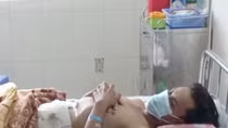 Người đàn ông bị lưỡi máy cắt cỏ đâm thủng bụng
