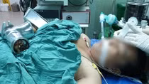 Thêm một phụ nữ nhập viện với bàn tay phải trong máy xay cá