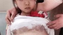 Bé gái 12 tuổi đi khám thai, hé lộ đường dây buôn người ở Trung Quốc
