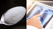 Hít đường có thể chữa khỏi viêm phổi?