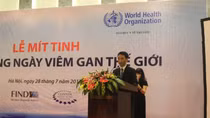 (CẢNH BÁO) Việt Nam là một trong số nước có số người viêm gan cao 