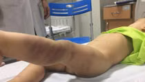 Thông tin thêm về cháu bé nghi bị bạo hành, bỏ rơi trong bệnh viện