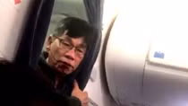 BS người Mỹ gốc Việt khởi kiện United Airlines