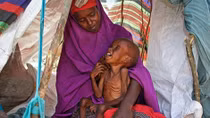 Đau xót 1,4 triệu trẻ em suy dinh dưỡng tại Somalia