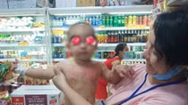 Cấp cứu bé 2 tuổi bị bỏng từ nước sôi nấu mì gói