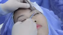 Khuyến cáo người dân chọn cơ sở dịch vụ thẩm mỹ