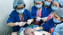 Mổ cứu sống bé sơ sinh non tháng có khối u khổng lồ