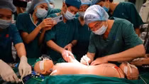 Các bác sĩ thêm một lần sinh ra hai bé