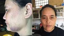 Nỗi đau tận cùng sau những cơn say