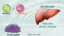 Tỷ lệ ung thư gan ở Việt Nam tăng nhanh