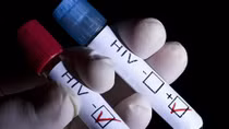 Pháp hỗ trợ để kiểm soát lây nhiễm HIV ở 8.000 thanh niên Việt Nam