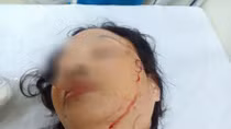 Bi kịch của người phụ nữ ly hôn 3 năm vẫn bị chồng cũ quấy rối