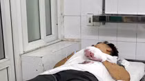 Tai nạn do pháo gia tăng những ngày Tết: Bài học không thừa