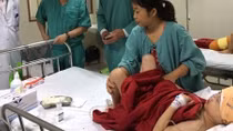 Tái tạo thành công khuôn mặt cho bệnh nhi bị dị tật hiếm gặp