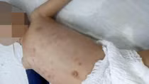 Cháu bé 4 tuổi bị người tình của mẹ đánh đập đến nguy kịch