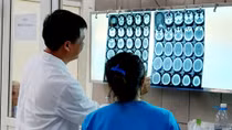Nam thanh niên xuất huyết não do ngộ độc ma túy đá