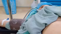 U mỡ to bằng quả bưởi con, sau 40 năm mới đi phẫu thuật