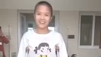 Thay xương đùi cho cô gái mắc ung thư 
