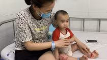 4 người tử vong vì tay chân miệng