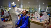 Không xét nghiệm SARS-CoV-2 dịch vụ theo yêu cầu