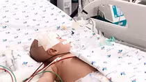 Cứu sống một bệnh nhi bị viêm màng não nguy kịch