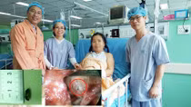Lấy dị vật 45 năm nằm trong tim một phụ nữ xứ dừa Bến Tre