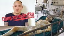 Bắt được hung thủ dùng xăng phóng hỏa 2 cô gái bị bỏng nặng