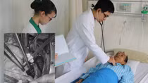 "Bóc" khối u nhầy trong tim cứu nam bệnh nhân khỏi nguy cơ đột tử 