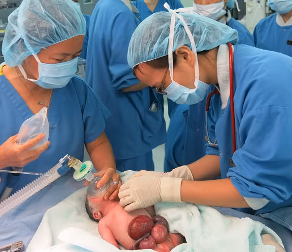 Em bé được các bác sĩ Vinmec hồi sức ngay sau khi sinh - hầu hết tạng của bé đều nằm ngoài thành bụng.