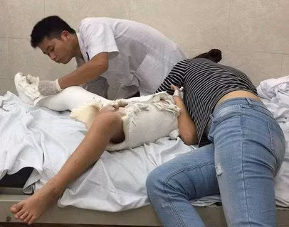 Cháu Trần Chí Kiên bị tai nạn gãy xương đùi