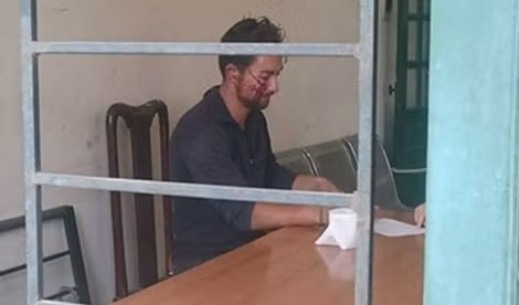 Anh Michael Hof đang tường trình lại sự việc.