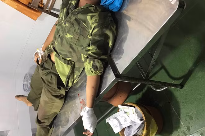 Anh Y Thông Chỉ Byă với vết thương đang được cấp cứu tại Bệnh viện Đa khoa vùng Tây Nguyên
