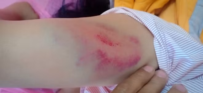 Những vết thương bầm dập trên thi thể anh H. (Ảnh do nhân vật cung cấp)