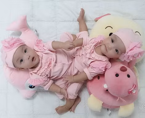 Hai bé trước khi mổ.