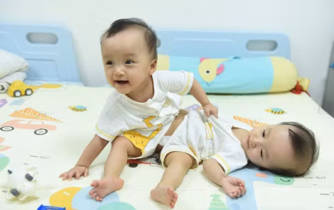 Hai bé Trúc Nhi - Diệu Nhi có cuộc sống "cộng sinh" suốt từ tháng 6-2019 tới khi được phẫu thuật tách dính.