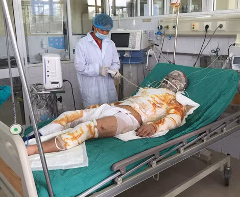 Chị Nguyễn Thị Ngọ đang chăm sóc em trai ruột của mình là bệnh nhân Đặng Văn Đức.