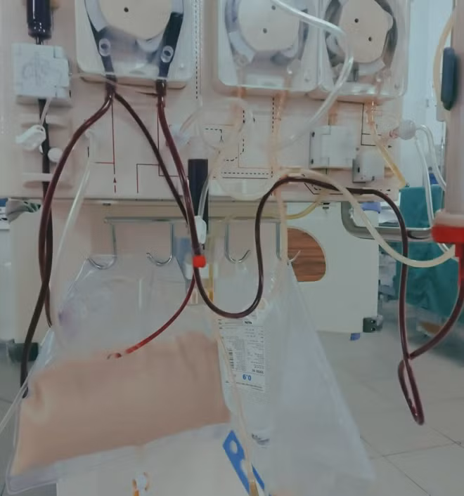 Máy lọc máu liên tục trong 90 giờ để cứu sống sản phụ.