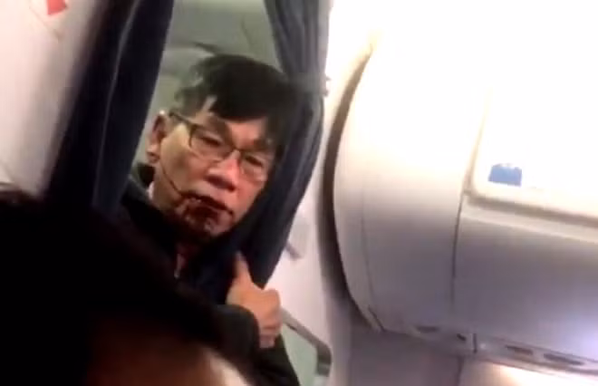 Ông David Dao, người bị hãng United Airlines "tấn công" trên máy bay. Ảnh từ Internet