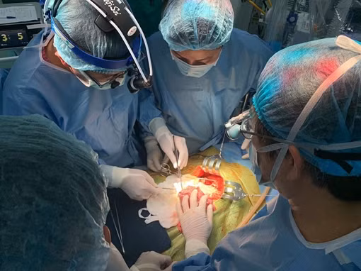 Cắt gan nội soi từ cô ruột ghép cho bé 5 tuổi bị ung thư ảnh 3