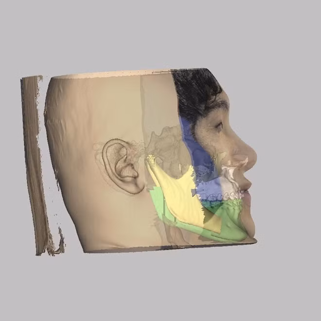 Thiết kế 3D sau mổ