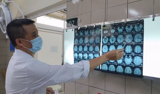 TS.BS Nguyễn Trung Nguyên đang chỉ những tổn thương não của bệnh nhân nhiễm độc thiếc