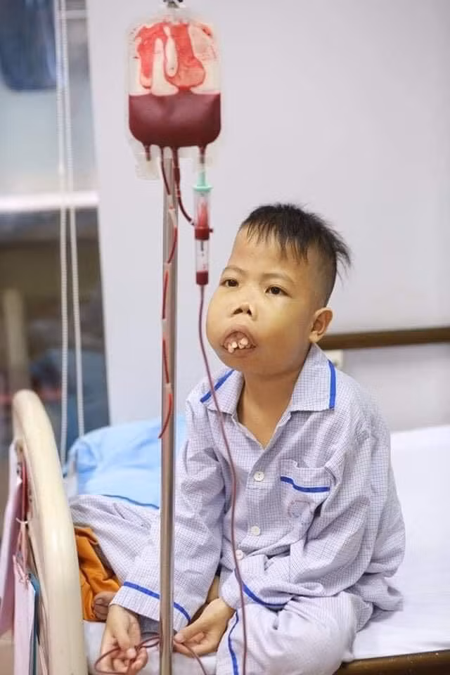 Nỗi đau mang tên Thalassemia ảnh 4