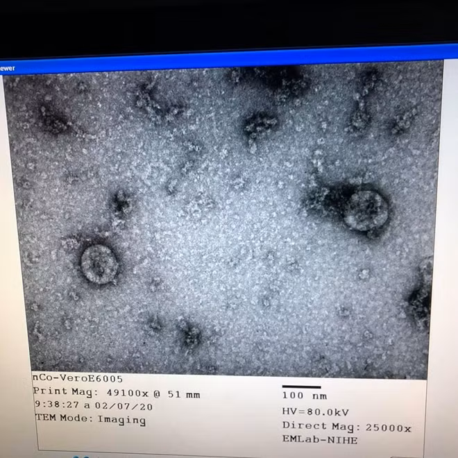 Virus Corona đã được nuôi cấy và phân lập thành công
