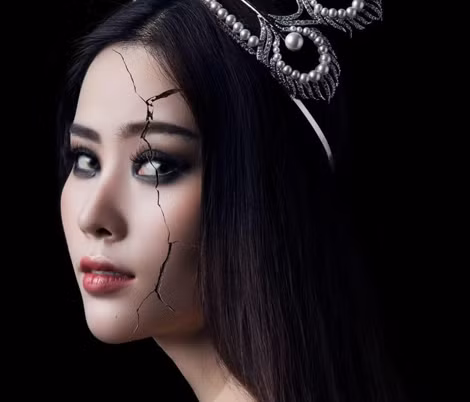 Nhiều người cho rằng, Nam Em nên tập trung đầu tư nhiều vào giọng hát thay vì mất thời gian với những chiêu trò để đánh bóng tên tuổi.