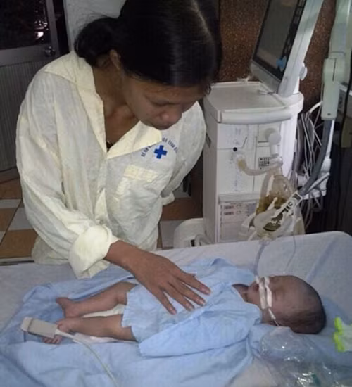 Bé sơ sinh hơn 1 tháng tuổi đang nguy kịch vì nhiễm trùng uốn ván nghi do y tá dùng kéo cắt dây rốn.