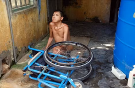 35 năm qua, anh Nguyễn Hồng Nguyên phải sống trong cảnh bệnh tình dày vò. Mang gương mặt trẻ thơ, anh Nguyên cả ngày ngồi “sửa xe” như thế này. Nỗi đau da cam cứa vào trái tim đau buốt khi chứng kiến của sống suốt 39 năm qua của một chàng trai lẽ ra phải mang hình hài lành lặn… 35 năm qua, anh Nguyễn Hồng Nguyên phải sống trong cảnh bệnh tình dày vò. Mang gương mặt trẻ thơ, anh Nguyên cả ngày ngồi “sửa xe” như thế này. Nỗi đau da cam cứa vào trái tim đau buốt khi chứng kiến của sống suốt 39 năm qua của một chàng trai lẽ ra phải mang hình hài lành lặn…