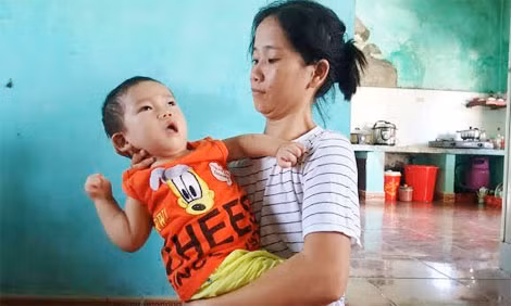 Bé Nguyễn Đăng Khoa bị bại não trong vòng tay mẹ.