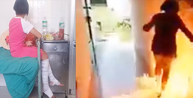 Nạn nhân bạo lực học đường có hành vi “đốt trường” ở Khánh Hòa. Ảnh Nguyễn Chung.