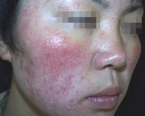 Tẩy trắng siêu tốc là trái với quy luật sinh lý tự nhiên của da...